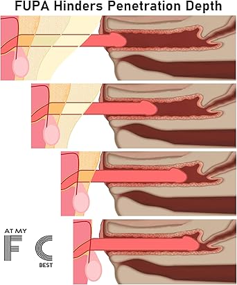 Mens FUPA Compressor | Penis Lengthener Underwear | Natural FUPA Lift FUPA Tuck - Image 5